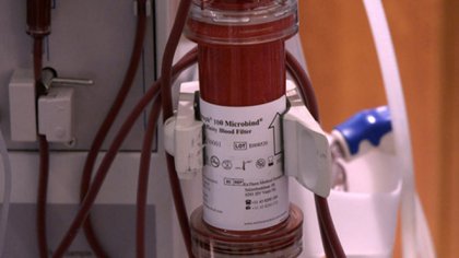 Así es el filtro para eliminar el virus de la sangre a través de una máquina de diálisis