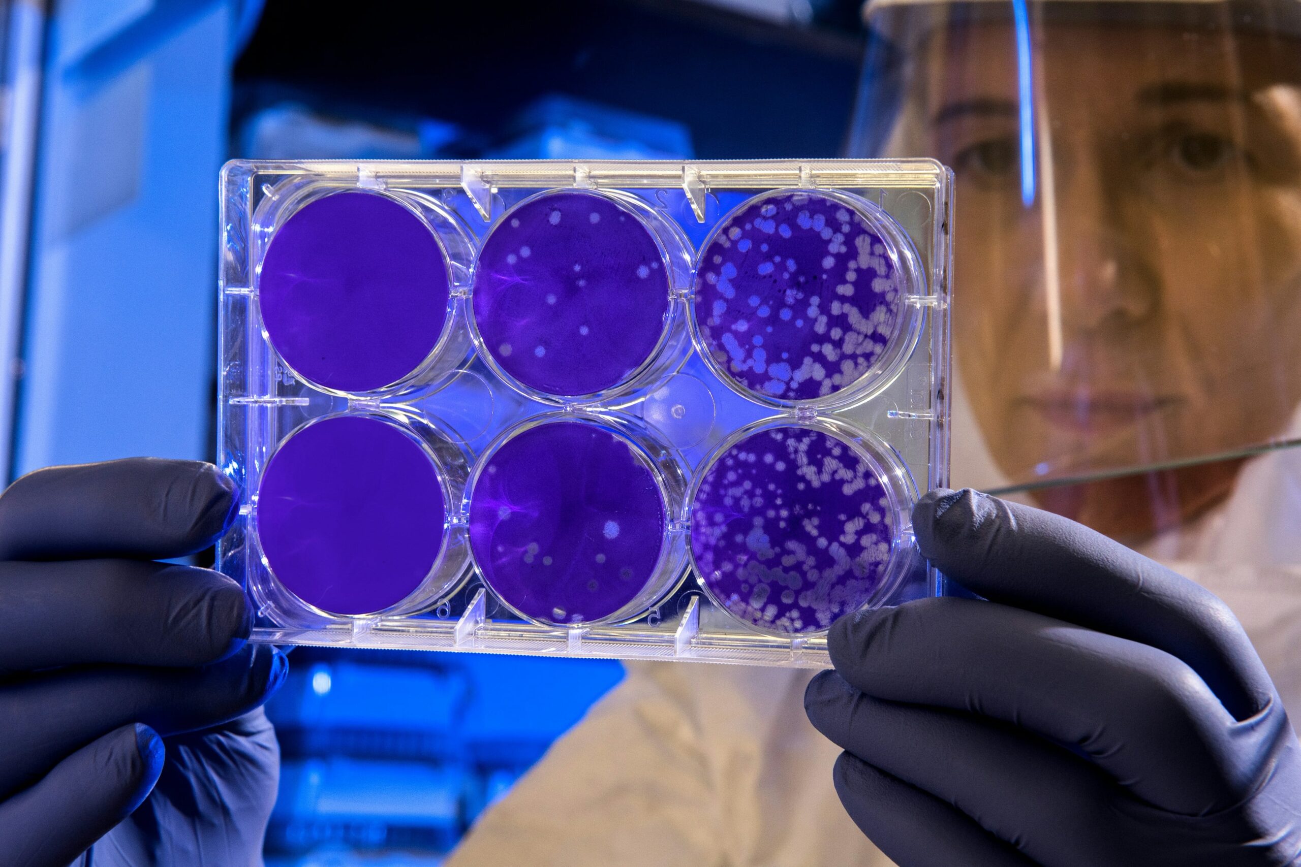 Bacteria